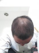 如果治不好该怎么办