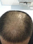 30秒，解决你的痛