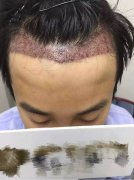 我要摆脱这种病