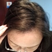 大脑门的烦恼太烦了