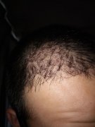 这种痛苦不想懂