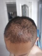 这样的解决方法是较好的