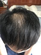 我的心病被医好了