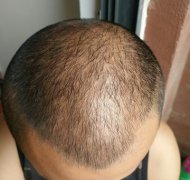 我真的不想再经历一次了