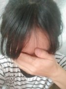 怎么挽救脱落的头发