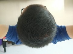 家族遗传是个通病