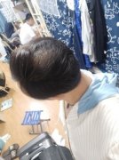 脱发的完美解决方法