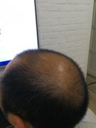 不要错过最重要的