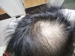 受伤的心灵怎么弥补