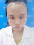发际线是我永远的痛