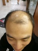 烫发和拉直对头发的伤害