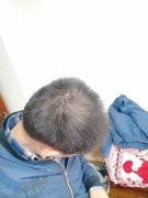 脱发是销售的死穴