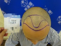 下定决心要改变