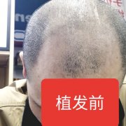 长发飘飘变成了短发