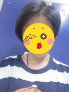 头发稀少的女生的心路历程