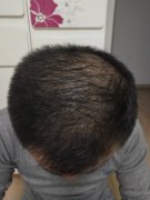 我的形象问题该怎么解决