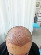 不重视头发的后果