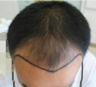 不注重头发的结果