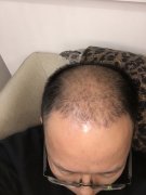 一言难尽的头发