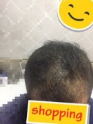 终于摆脱了不喜欢的绰号