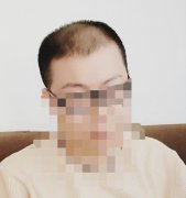 头发太过稀疏是什么原因