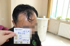 我获得了新生