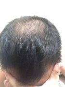 较好的年纪，我却老了好几岁