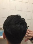 脱发的我很悲哀