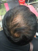 不在意头发的后果