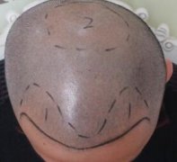 一切重新开始