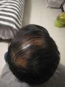 看来头发还是很重要的