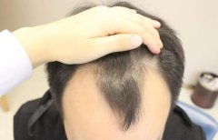 见证我的改变