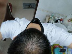 头发稀少所带来的苦恼