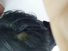 脱发有遗传的因素吗