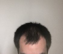 头发的蜕变史