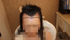 天生高额头的烦恼