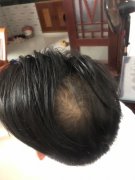 小伙子变成了大叔