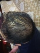 快速恢复颜值巅峰