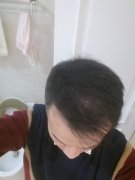 不想再让别人看见我的头发