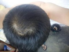 怎么才能让自己恢复完美形象