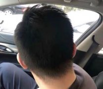 拯救头发稀疏的神器