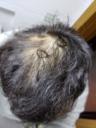 漂流的头发何时归