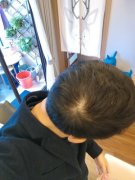 清秀的面容总要有头发来支撑