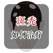 斑禿植發效果好嗎