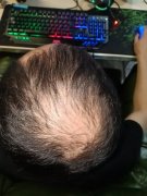 怎么拯救不算英俊的脸庞