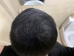 苏玫氏头发纤维粉拯救了我的形象