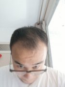 不英俊的面孔也需要拯救