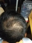 怎么解决形象的问题