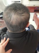 一定要解决的形象问题