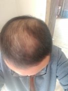 改变我命运的那天